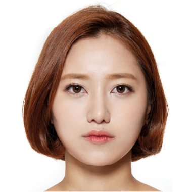 Sau khi cấy mỡ