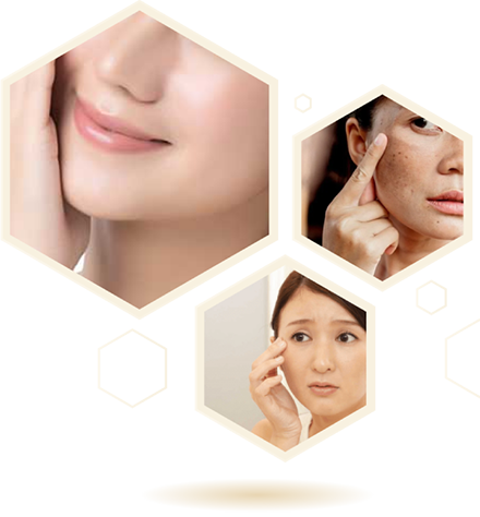Lợi ích của việc cấy mỡ tự thân làm đầy